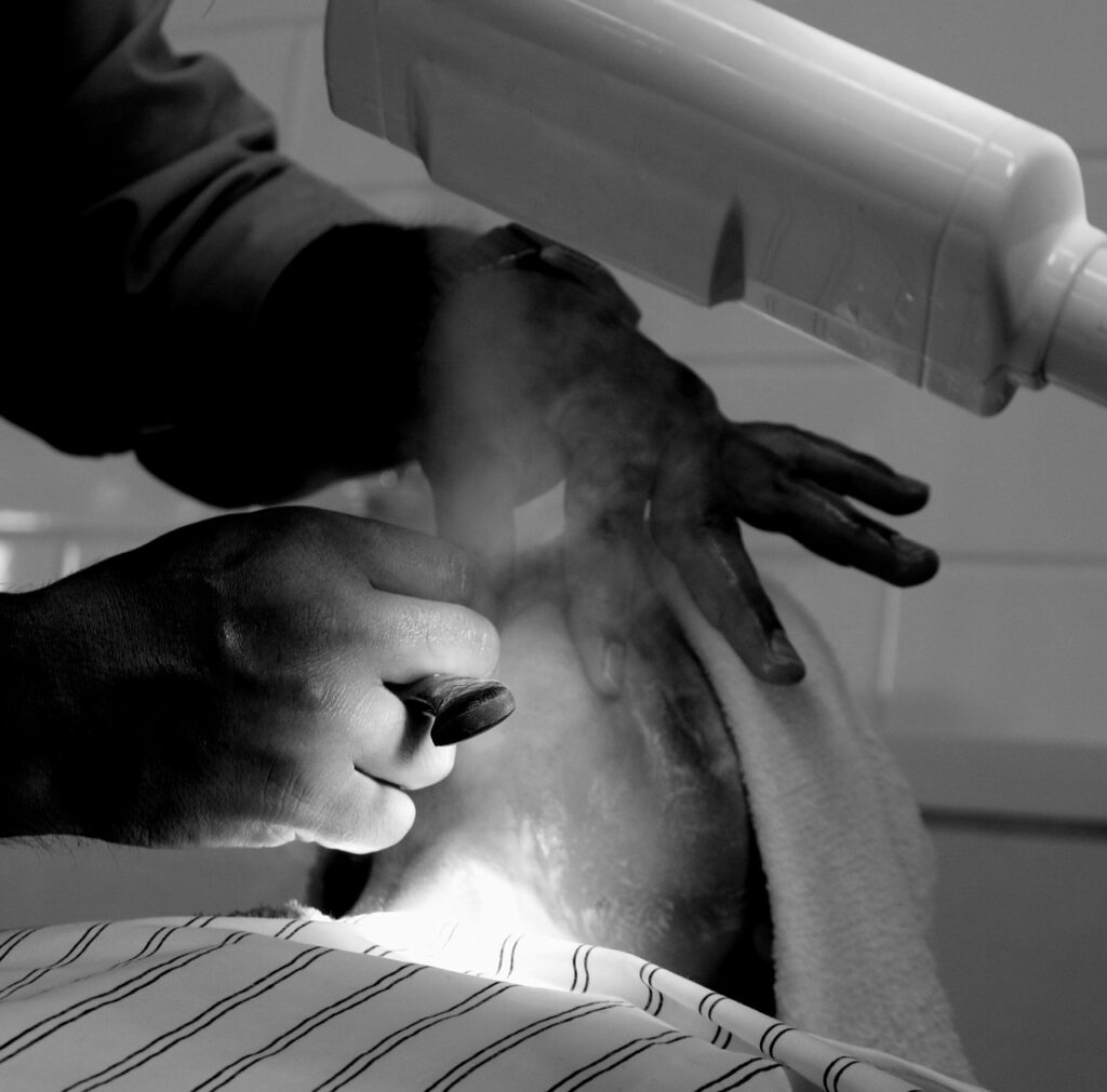 髭脱毛前に剃るべき理由とは？