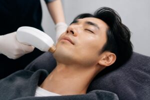 メンズのヒゲ医療脱毛は効果が出るまでの期間はどれくらい？