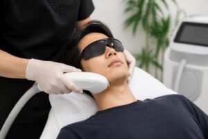 髭脱毛を考える薄い人は何回通うべき？
