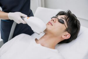 髭の医療脱毛にかかる期間はどれくらい？